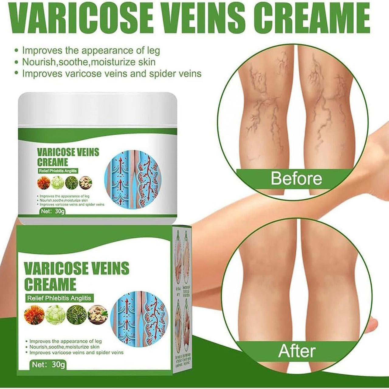 Varicose Vein Cream ( BUY 1 GET 1 FREE )