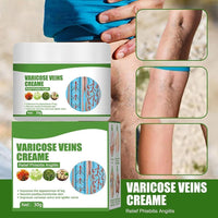 Varicose Vein Cream ( BUY 1 GET 1 FREE )